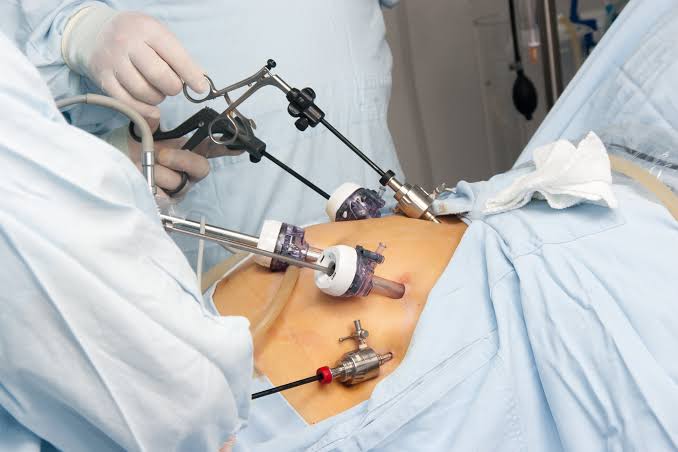 How Long Is Gallbladder Surgery Recovery?